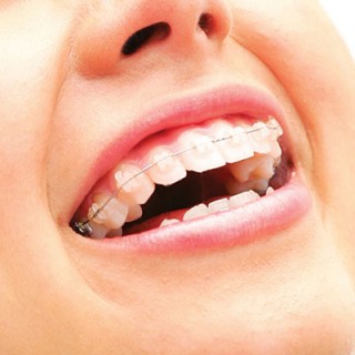orthodontics-2
